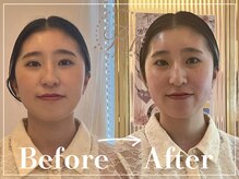 R-1ビューティーサロン 表参道/Before &After