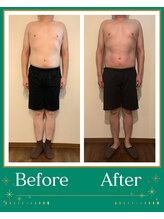 シャルマン(CHARMANT)/速攻オーダーメイド痩身