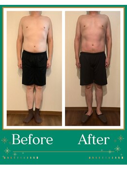 シャルマン(CHARMANT)/速攻オーダーメイド痩身