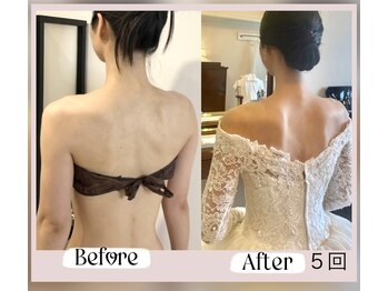 蒼(so)/肩甲骨周りの機能改善に特化。