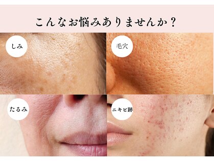 エルナ(ELUNA)の写真