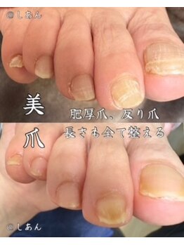 しあん 京都の写真/自分ではお手入れが難しい足爪も、専門技術で美しく快適な足元へ整えます。