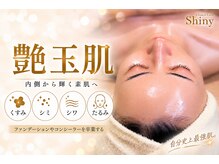 シャイニー(Shiny)