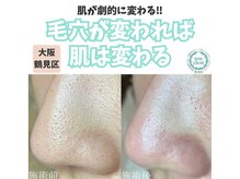 リッカロッカ(RIKKA&ROCCA)/毛穴が変われば肌も変わる