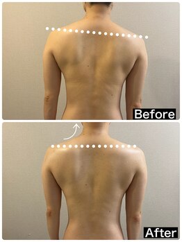 ハーズプラス(hers+)/背中の歪みから解消