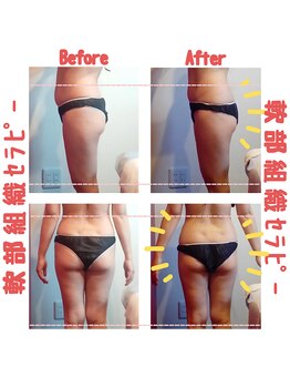 ビューティサロン キヨの部屋(beauty salon)/【軟部組織セラピー】　１回