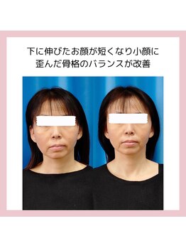 目元 口元のたるみ 眉間シワ改善専門サロン/顔のバランス改善をしたい方向け