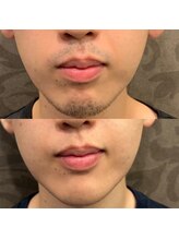 フェリーバ 浦和店(FELIVA)/Before&After