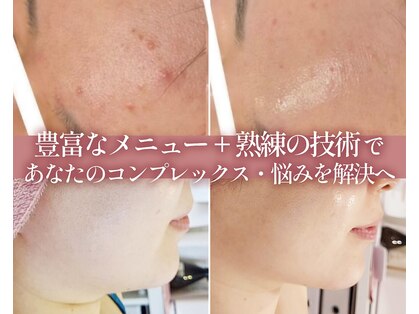 カシェボーテ(CACHE BEAUTE)の写真