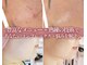 カシェボーテ(CACHE BEAUTE)の写真