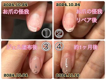 お爪レスキュー