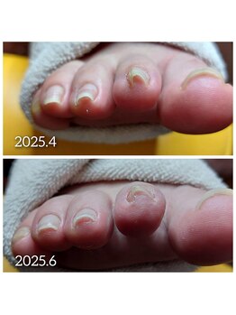 爪切り屋 足楽/