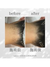 ココ シャルール(salon COCO CHALEUR)/Before　After