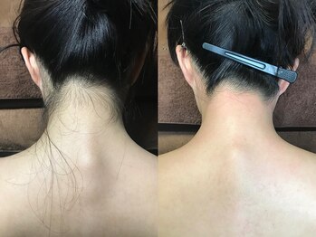 クラウン ジュエルズ(CROWN JEWELS)/うなじワックス脱毛 正面