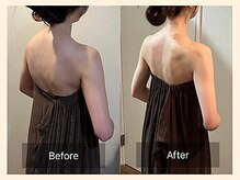 ラフリー 八丁堀院(RUFFREE)/背中美人に大変化【八丁堀】