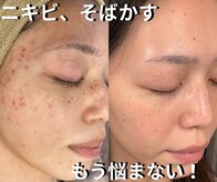 アディス 心斎橋(ADISE)