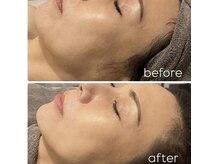 ラルミエール 緑店はなれ(la lumiere)の雰囲気（新陳代謝を活性化させ肌のハリ、弾力や様々な肌悩みに効果有り☆）