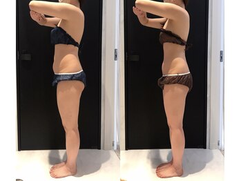 リボディ 表参道(An re Body)/before→after