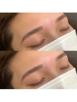 眉サロン デュアル 恵比寿(DUAL)/眉周りとおでこにWaxをかけて☆