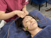 ビースタイル(B-style)/【美容鍼灸】電気美容鍼施術