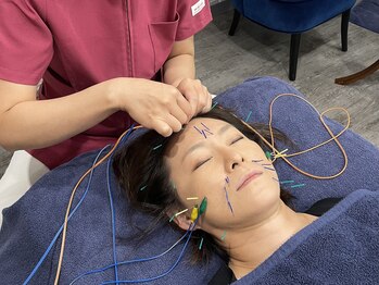 ビースタイル(B-style)/【美容鍼灸】電気美容鍼施術