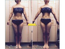 整体 美容サロン フェールラヴィ/【整体+痩身】