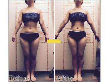 整体 美容サロン フェールラヴィ/【整体+痩身】