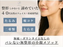 ブリリアンス(Brilliance)