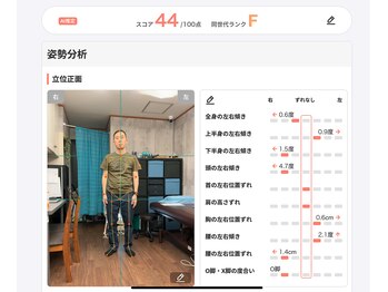 しじみ整体ラボ/歯科院長先生の初回姿勢