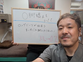 クシロ鍼灸整骨院/【O脚矯正】お客様の声