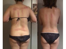 南国 蒼 越谷(ao)/3ヶ月のビフォーアフター！