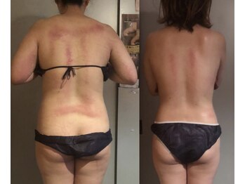 南国 蒼 越谷(ao)/3ヶ月のビフォーアフター!