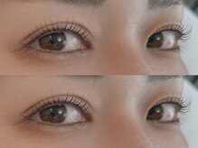 ティーツリー(tea tree)/