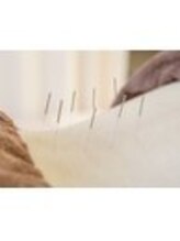 桜琴鍼灸治療院 赤坂店/腰痛施術