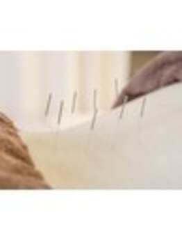 桜琴鍼灸治療院 赤坂店/腰痛施術