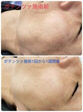 縁(en)/ポテンツァ