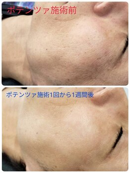 縁(en)/ポテンツァ