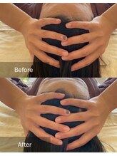 ブレア(BLAIR)/【男性OK】脳洗浄ヘッドスパ