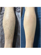 カナウ(KANAU)/スポーツをする方におすすめ！