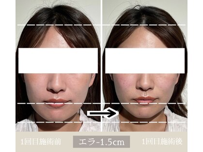 ユウサク(Yusaku)の写真