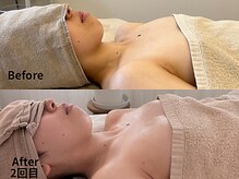 ニッコ(nicco)の雰囲気（大人気バストケア&アロマリンパメニューでボディーメンテナンス）