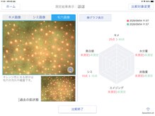 べべ 金沢駅前店(Be’be’)の雰囲気（キメ、角栓カメラで毛穴ファイリングします）