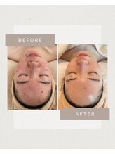 オウル(ow_l)/最高品質の結果の出るハーブ