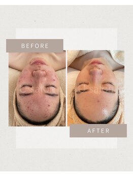 オウル(ow_l)/最高品質の結果の出るハーブ