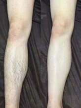 メンズ シンバ(SIMBA)/☆ ビフォーアフター ☆