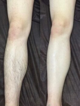 メンズ シンバ(SIMBA)/☆ ビフォーアフター ☆