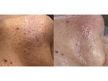 ジェリー(JERRY)/別人級