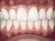 エルモ(elMo.)の写真/歯科提携サロン◎【白く輝く歯は人に好印象を与え、口元を気にせず笑うことが自信へと繋がります♪】