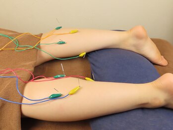 鍼灸治療院 桜セラピー院/