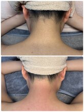 シュガーリングハウス ベル(Bell)/うなじシュガーリング！